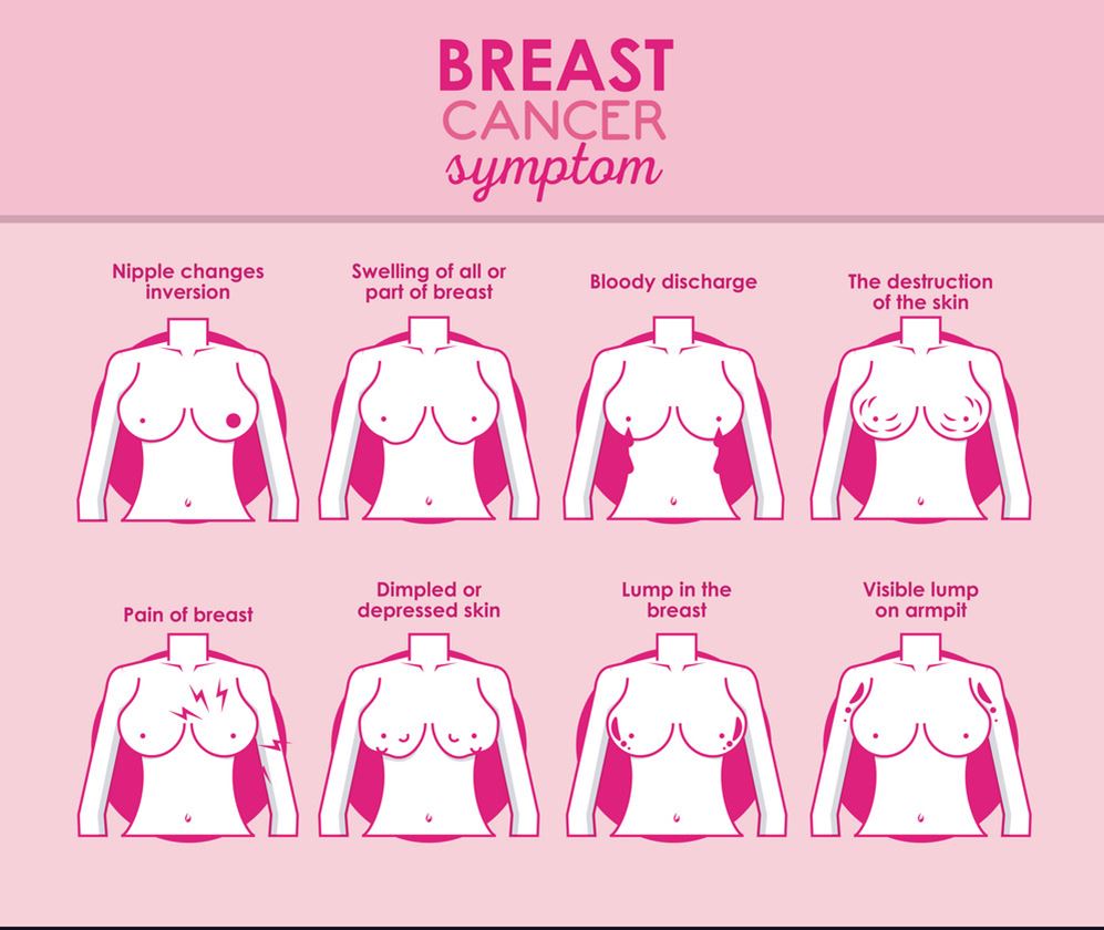 Breast Cancer Symptoms